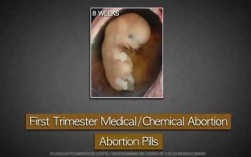 药物堕胎过程（药物堕胎过程视频）