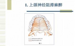 上颌神经阻滞过程（上颌神经阻滞过程图）
