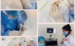 乳管内窥镜过程（乳导管内窥镜系统）