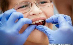 矫正牙齿全过程（10岁儿童矫正牙齿全过程）
