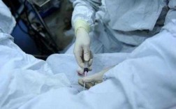 人工受精移植手术过程（人工受精移植手术过程视频）