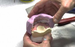 假牙过程（树脂假牙制作过程）