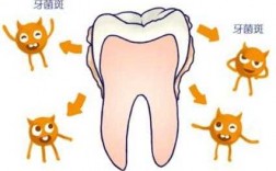 牙菌斑形成的过程（牙菌斑形成机制）