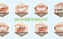 牙齿矫正治疗过程（牙齿矫正过程需要多长时间）