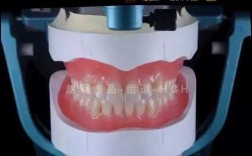 排牙的全过程（排牙的全过程视频）
