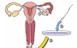 人工受精过程图（人工受精的方法和步骤图）