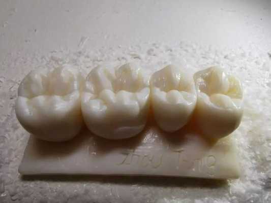 口腔雕牙过程（雕牙流程）-图2