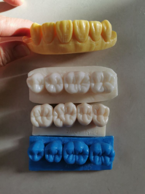 口腔雕牙过程（雕牙流程）-图3