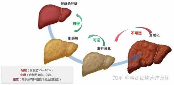肝脏变小的过程（肝脏变小可能是什么问题）-图3