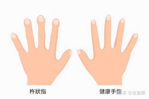 手指的变化过程（手指有什么变化）-图2