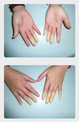 手指的变化过程（手指有什么变化）-图1