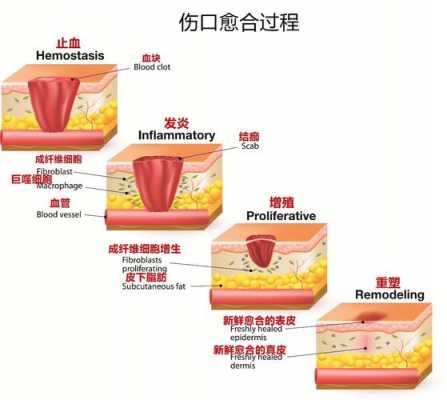 刀口愈合期过程（刀口愈合期过程图解）-图1