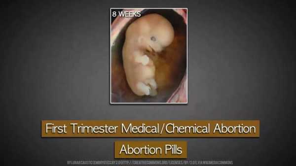 药物堕胎过程（药物堕胎过程视频）-图1