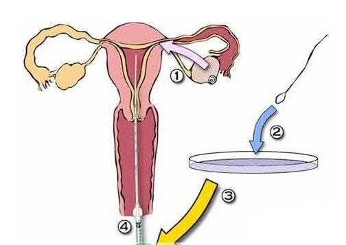 人工受精过程图（人工受精的方法和步骤图）-图1