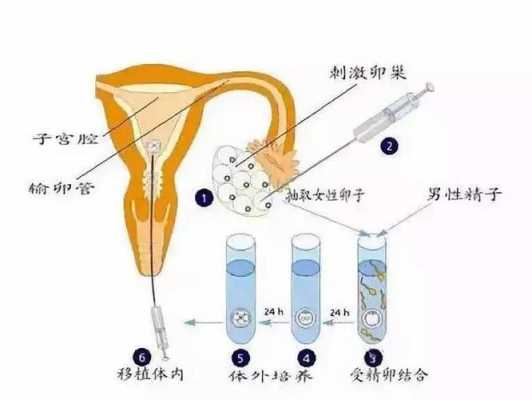 人工受精过程图（人工受精的方法和步骤图）-图3