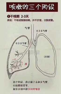咳喘过程（咳喘的主要症状是）-图1