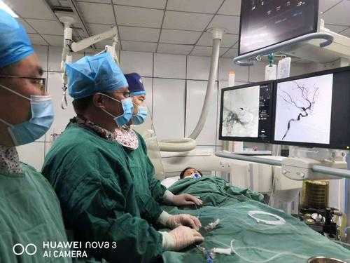 脑动脉瘤介入手术过程（脑动脉瘤介入手术过程中医院应该有视频监控吗）-图1