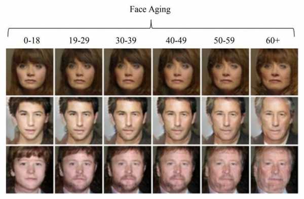 人脸衰老的过程（人体面部衰老的过程）-图2