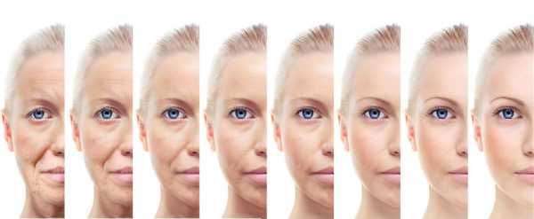人脸衰老的过程（人体面部衰老的过程）-图3