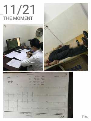 男心电图体检过程（男性做心电图多久可以怀孕）-图2