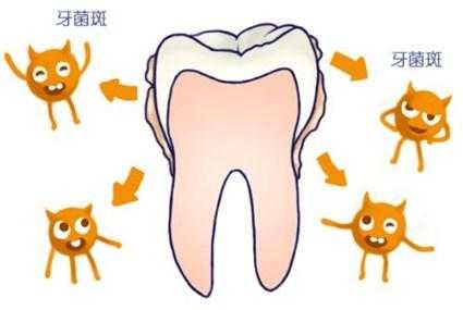 牙菌斑形成的过程（牙菌斑形成机制）-图1