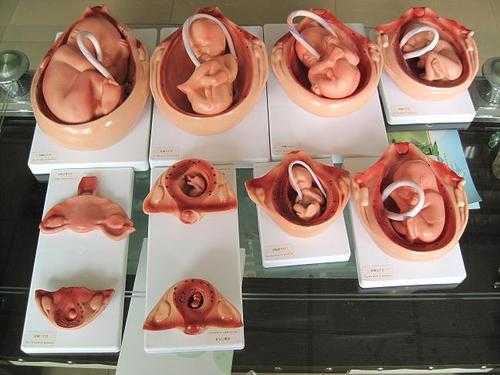 胚胎放置过程（胚胎是放在哪里）-图2