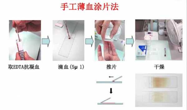 血液涂片制作过程（血液涂片的操作步骤）-图1