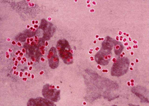 淋球菌感染过程（淋球菌感染过程图片）-图2