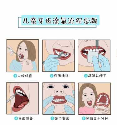 牙齿涂氟过程（儿童牙齿涂氟过程）-图2