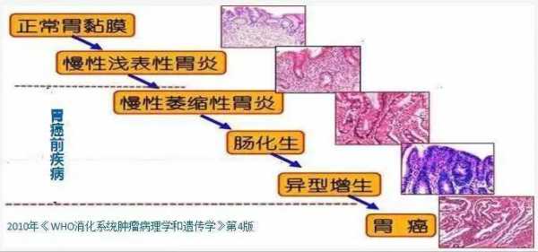 胃炎形成的过程（胃炎形成的过程有哪些）-图3