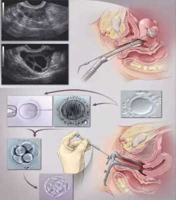 胚胎植入的过程（胚胎植入的过程图片）-图3