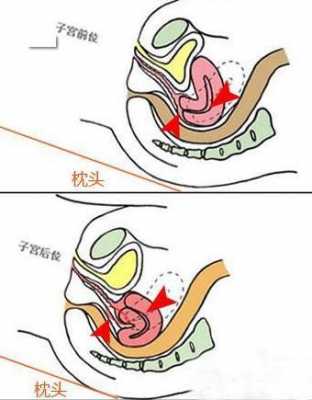 后位子宫受孕过程（后位子宫受孕过程图）-图3
