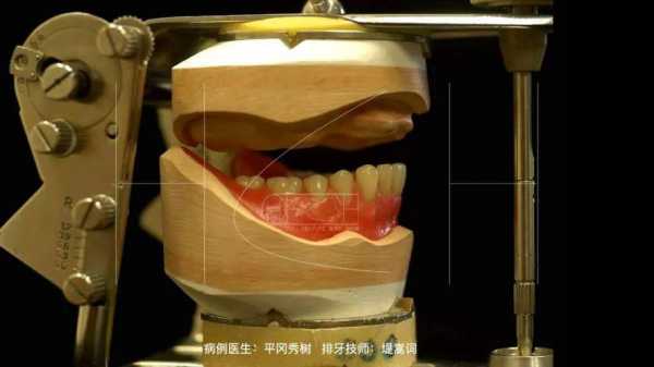 制作排牙全过程（排牙实验步骤）-图1