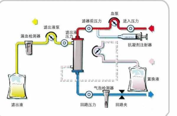 透析器过程（透析器工作原理图）-图2