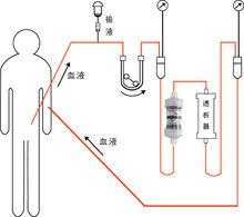 透析器过程（透析器工作原理图）-图1