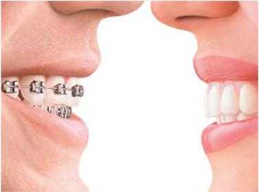 牙齿矫正的过程（牙齿矫正的过程中牙齿会松动吗）-图3