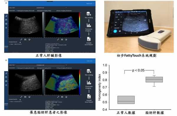 日语肝部检查过程（touch肝脏检查）-图3