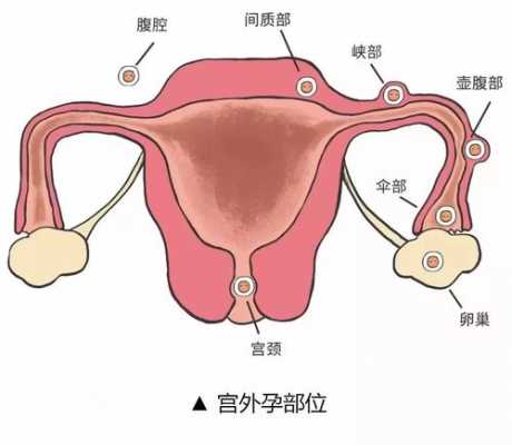 子宫受孕的过程（受孕的最佳子宫环境）-图3