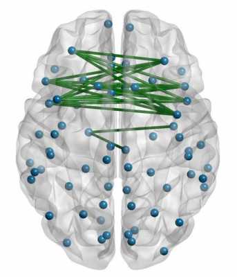 脑连接组研究过程（人脑连接组学）-图1