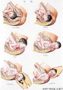 分娩过程最疼（分娩过程最疼的是哪个阶段）-图1
