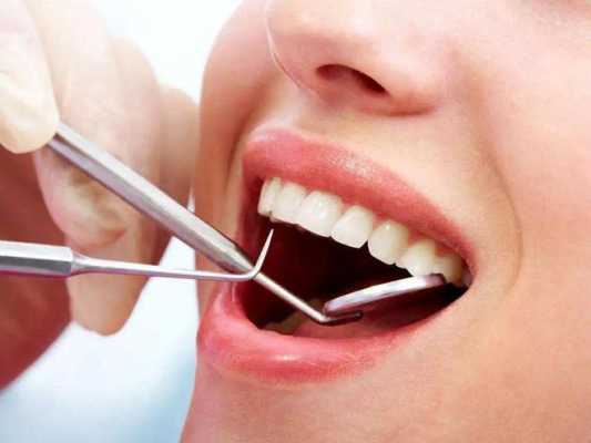补牙过程洗牙（补牙洗牙疼不疼）-图1