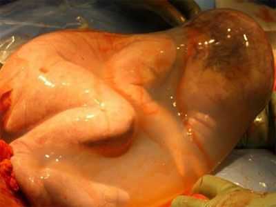 婴儿出生过程视频（婴儿出生过程视频教程）-图2