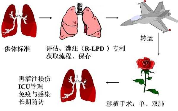 肺灌注过程需要多久（肺灌注对身体的副作用）-图2