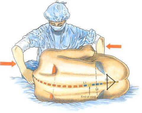 下肢麻醉过程（下肢麻醉过程图片）-图2