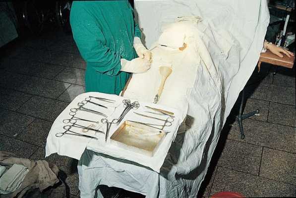 开刀手术过程（开刀手术过程图）-图3