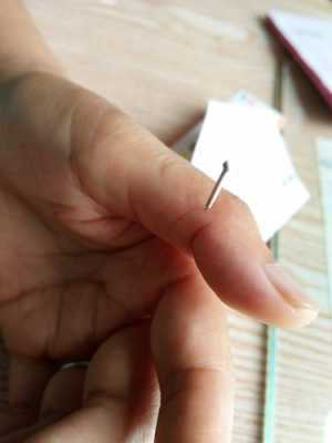 针刺小指的过程（针灸扎小拇指治什么病）-图3