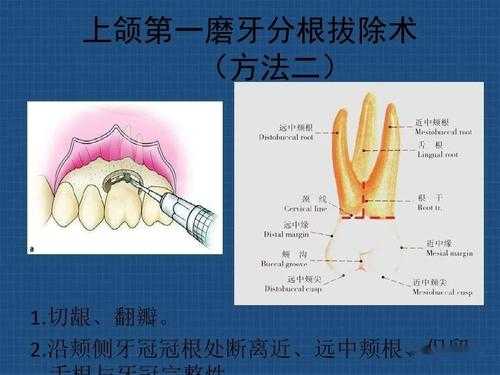 牙根形成过程6（牙根形成术概念）-图2