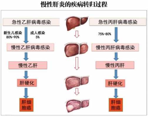 肝炎损伤的过程（肝炎损伤的过程是怎样的）-图1