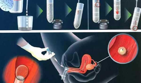 试管胚胎培养过程图片（试管婴儿胚胎培育过程）-图2