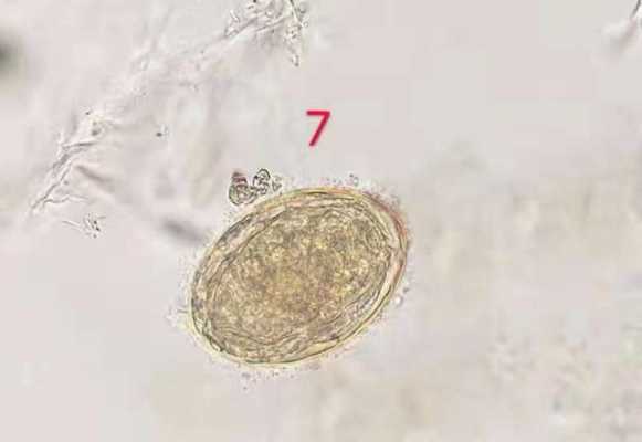 卵成虫的过程（卵虫是什么）-图3